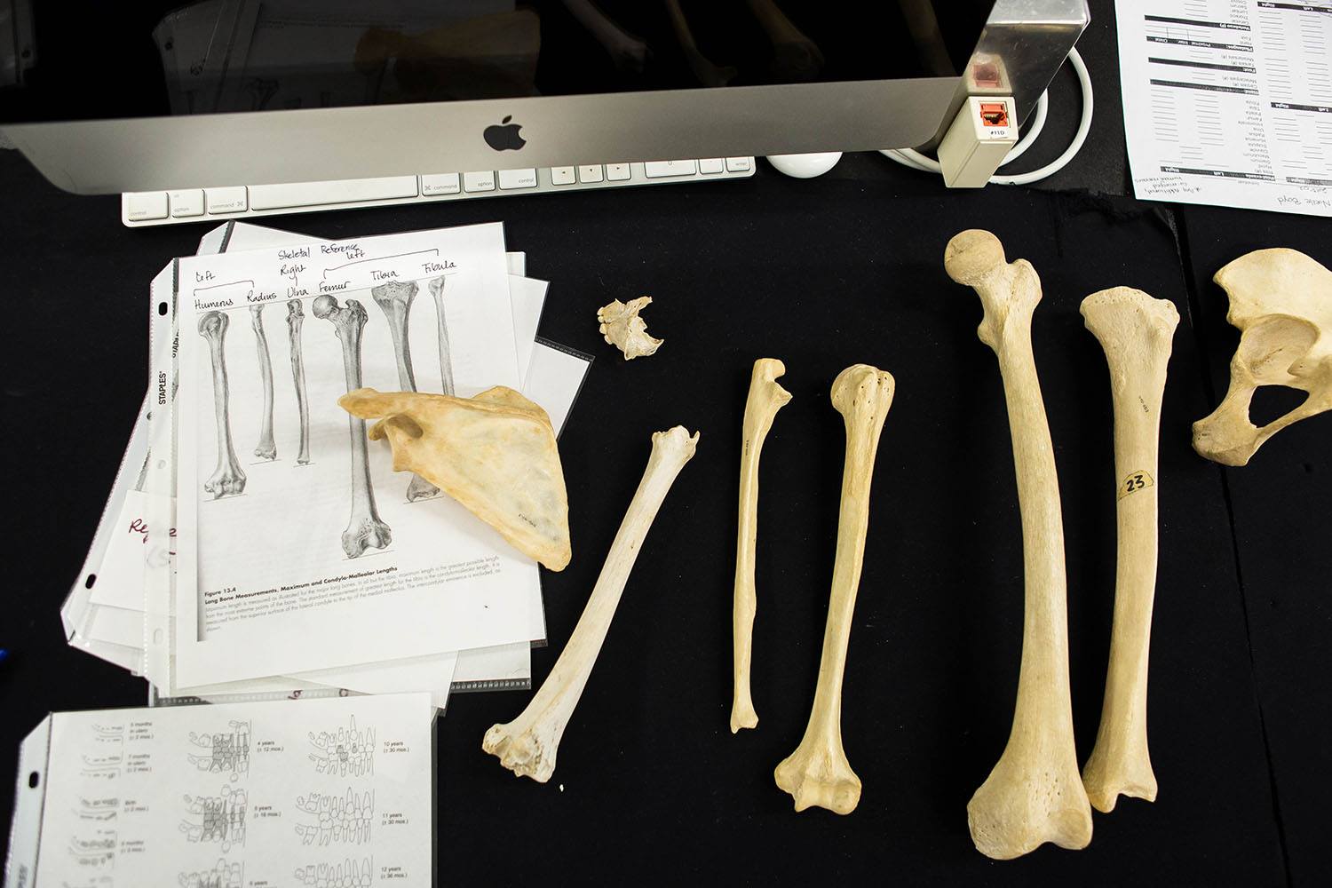 Overhead view of bone specimens arranged alongside anatomical illustrations.