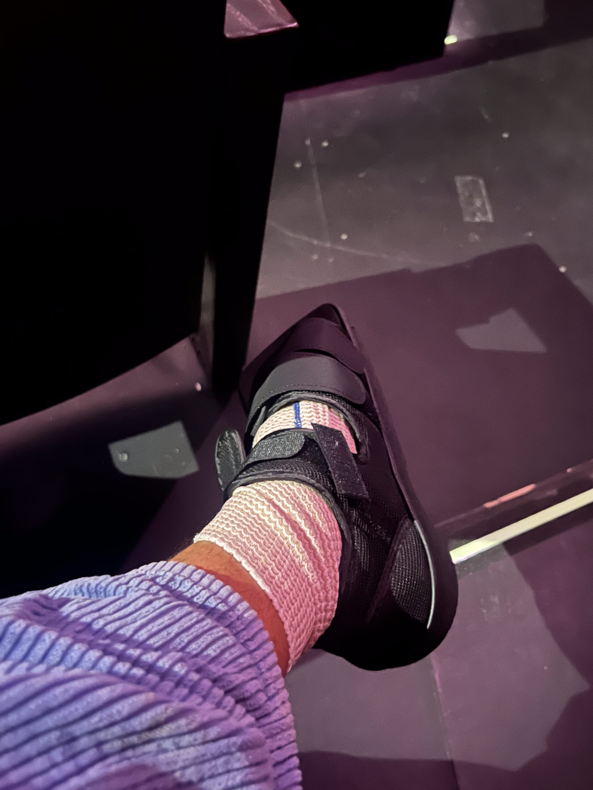 Sprained ankle less than a week before opening night:(